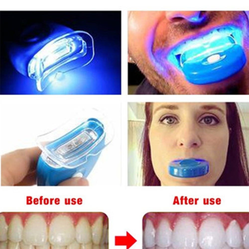 LED Teeth Whitening Light Whit - Teeth Whitening Laser Treatment のレビューと価格