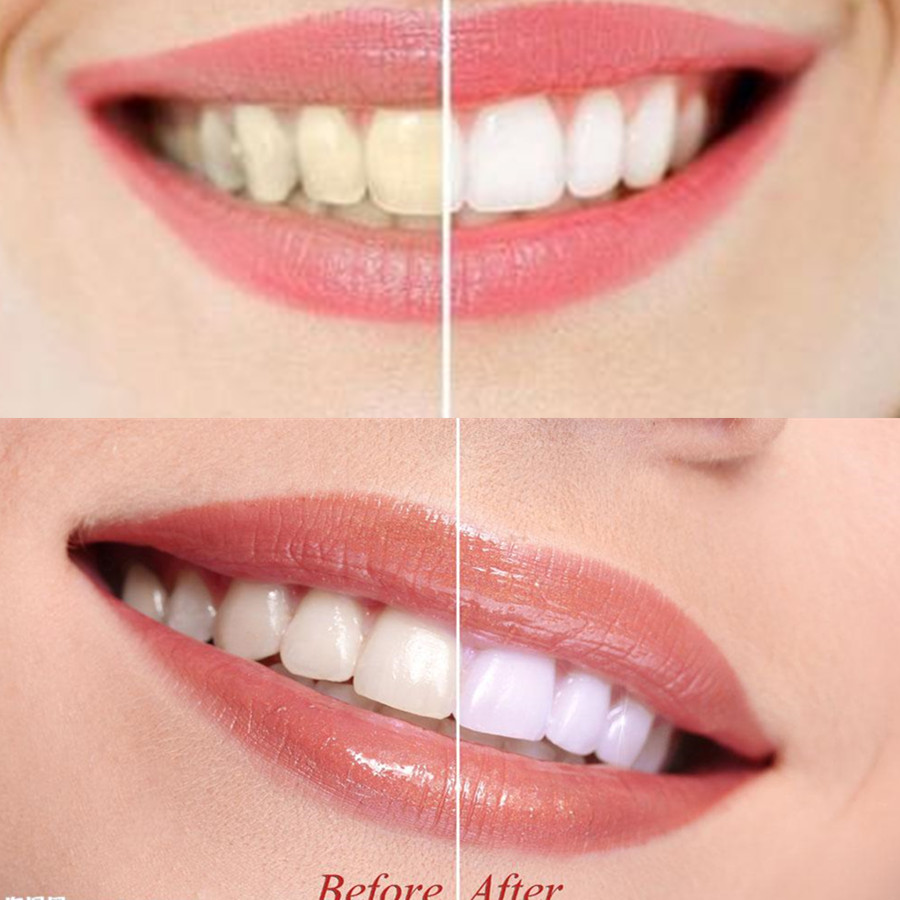 Bamboo Charcoal Teeth Tooth De - Teeth Whitening Q&M のレビューと価格