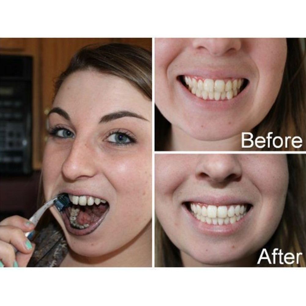 Bamboo Charcoal Teeth Tooth De - Teeth Whitening Q&M のレビューと価格