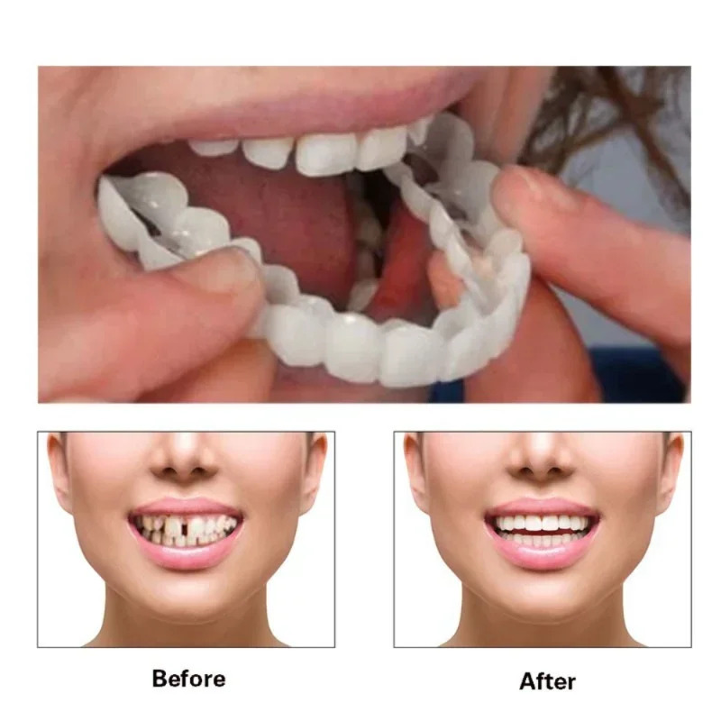 Quick Makeup Teeth Veneers, In - Teeth Whitening Quick のレビューと価格