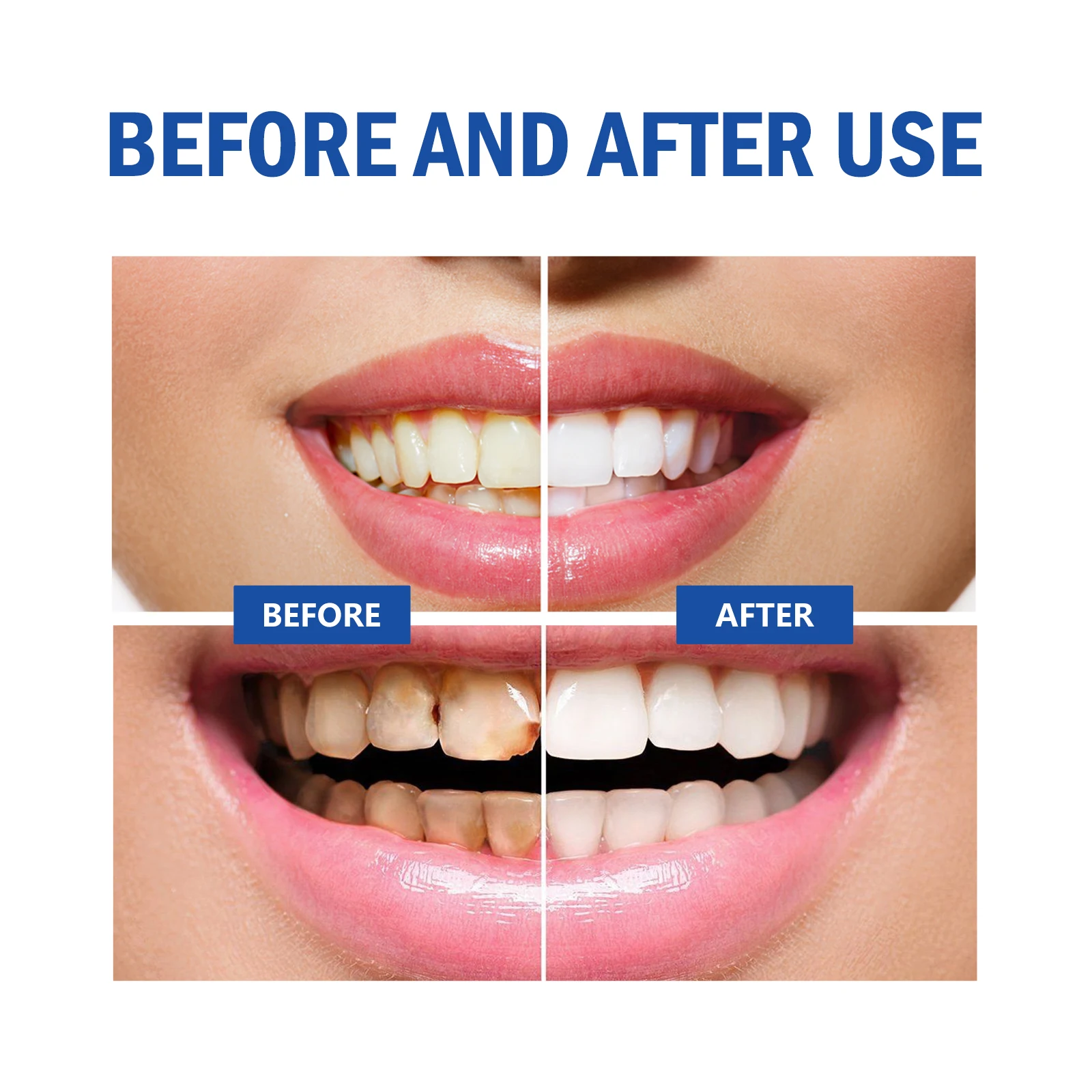 2pcs Gum Repair Gel Spray Deep - Teeth Whitening Xylitol のレビューと価格