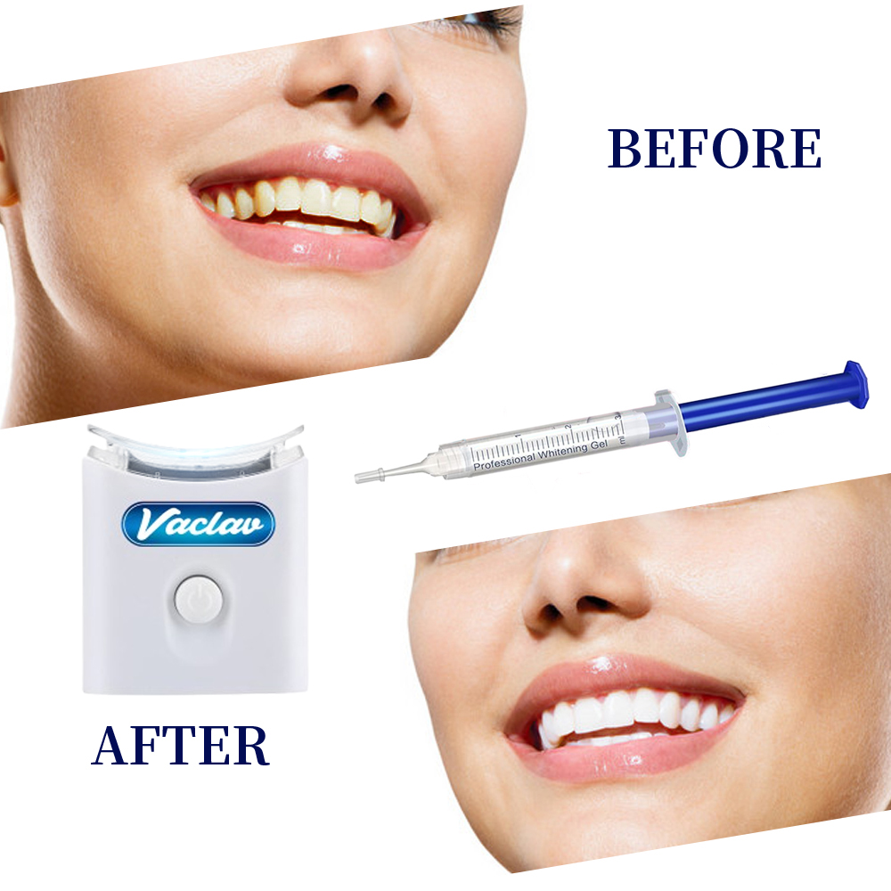 Mint Teeth Whitening Gel Syrin - Teeth Whitening Kit At Home のレビューと価格