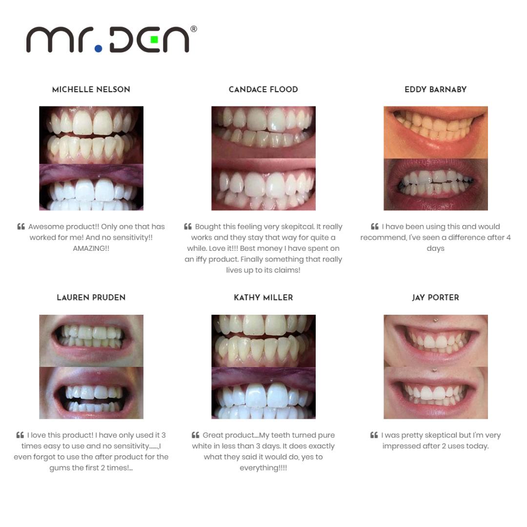 Dr. Whiten 3 Pack Teeth Whiten - Teeth Whitening Light のレビューと価格
