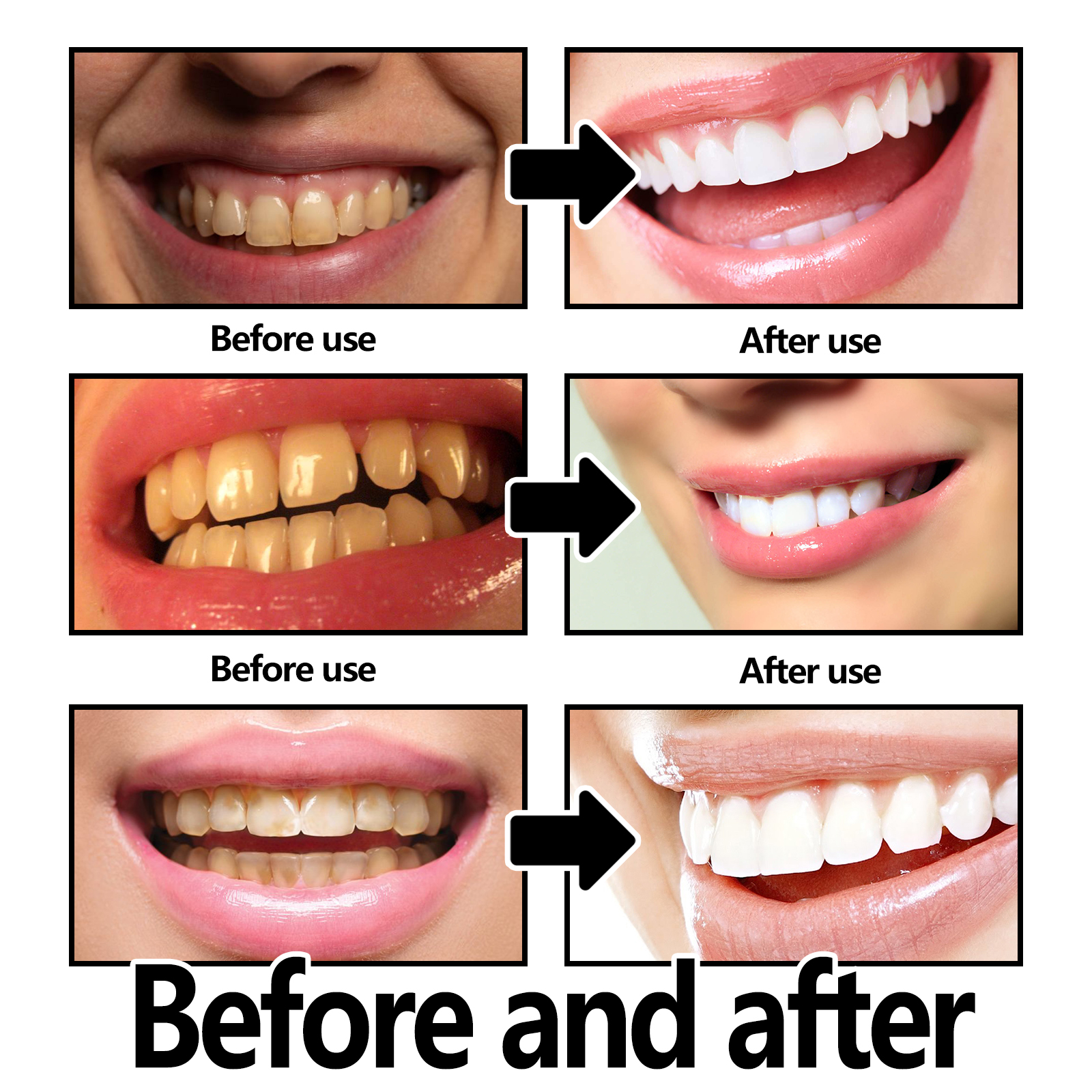 Xylitol Mint Purple Toothpaste - Teeth Whitening Xylitol のレビューと価格