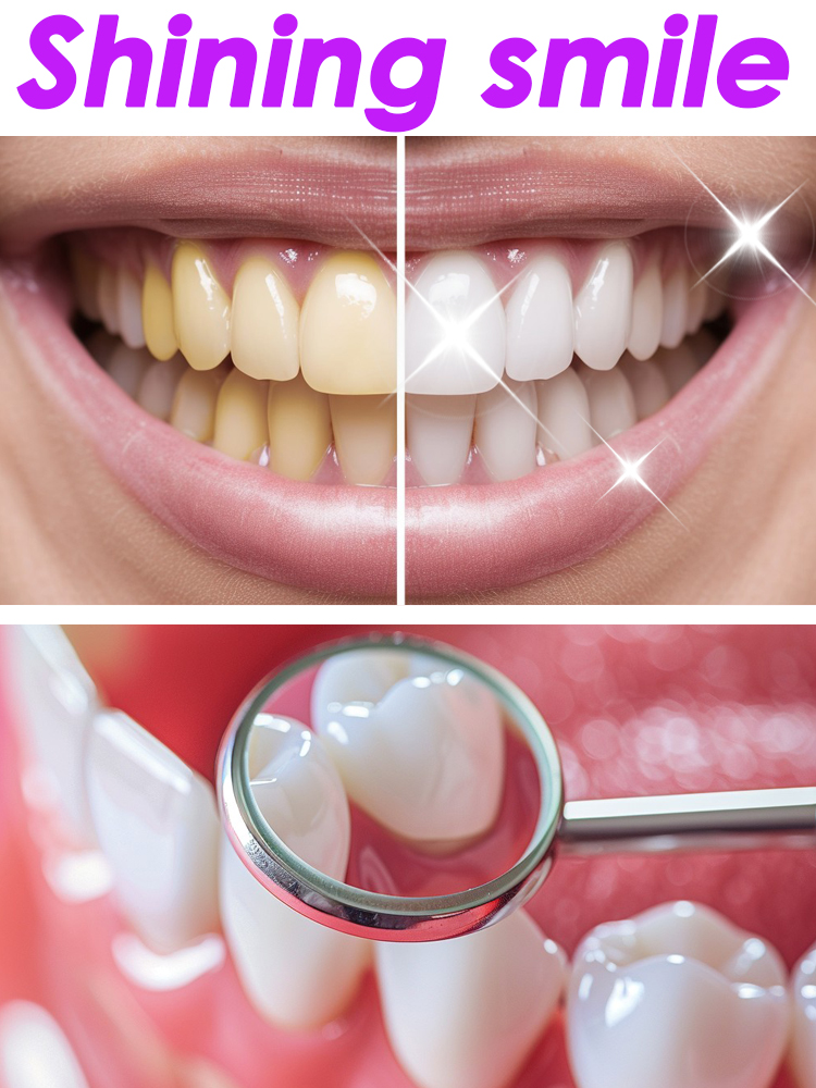 GlorySmile Teeth Whitening Fru - Teeth Whitening Xylitol のレビューと価格