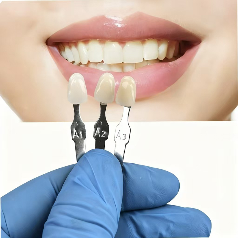 VITA 16 Colors Teeth Shade Gui - Teeth Whitening Professional のレビューと価格
