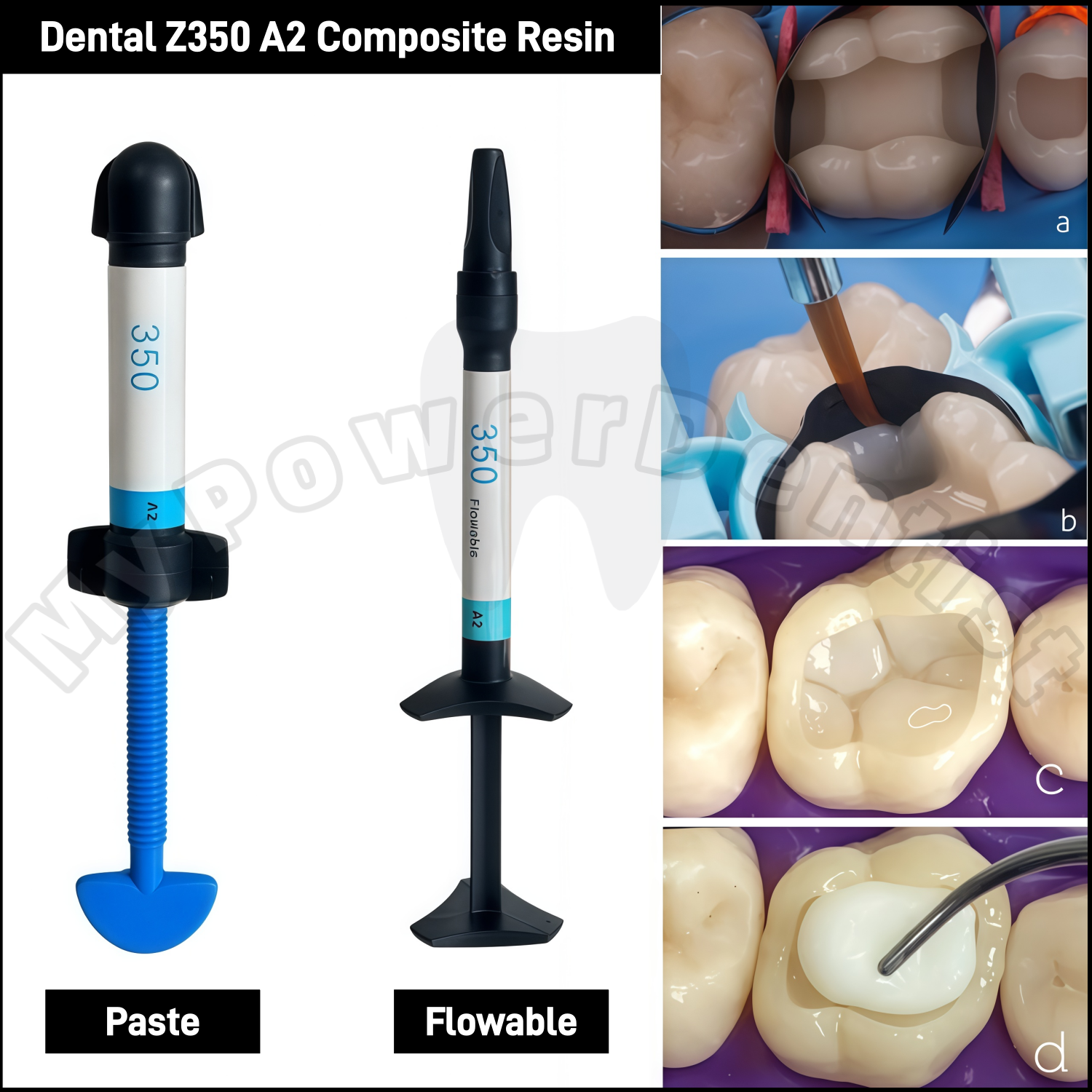 Z350 A2  Dental Composite Resi - Teeth Whitening Light のレビューと価格