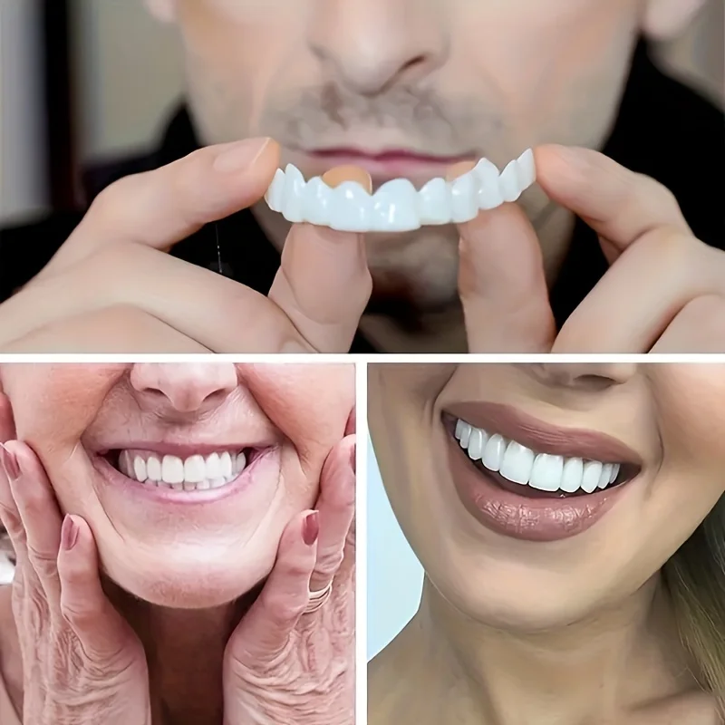 Color Matching Natural Teeth V - Teeth Whitening Options のレビューと価格