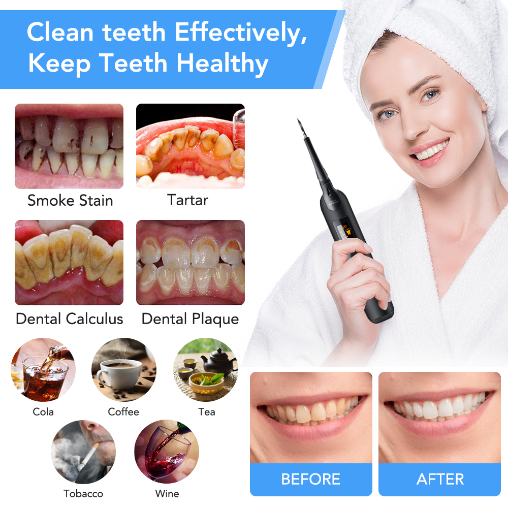 Teeth Tartar Remover Electric  - Teeth Whitening Kit At Home のレビューと価格