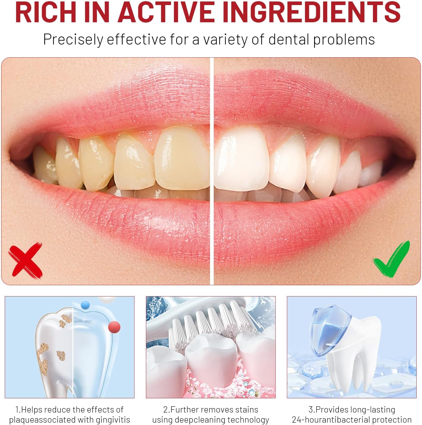Niacinamide Whitening Toothpas - Teeth Whitening Cream のレビューと価格