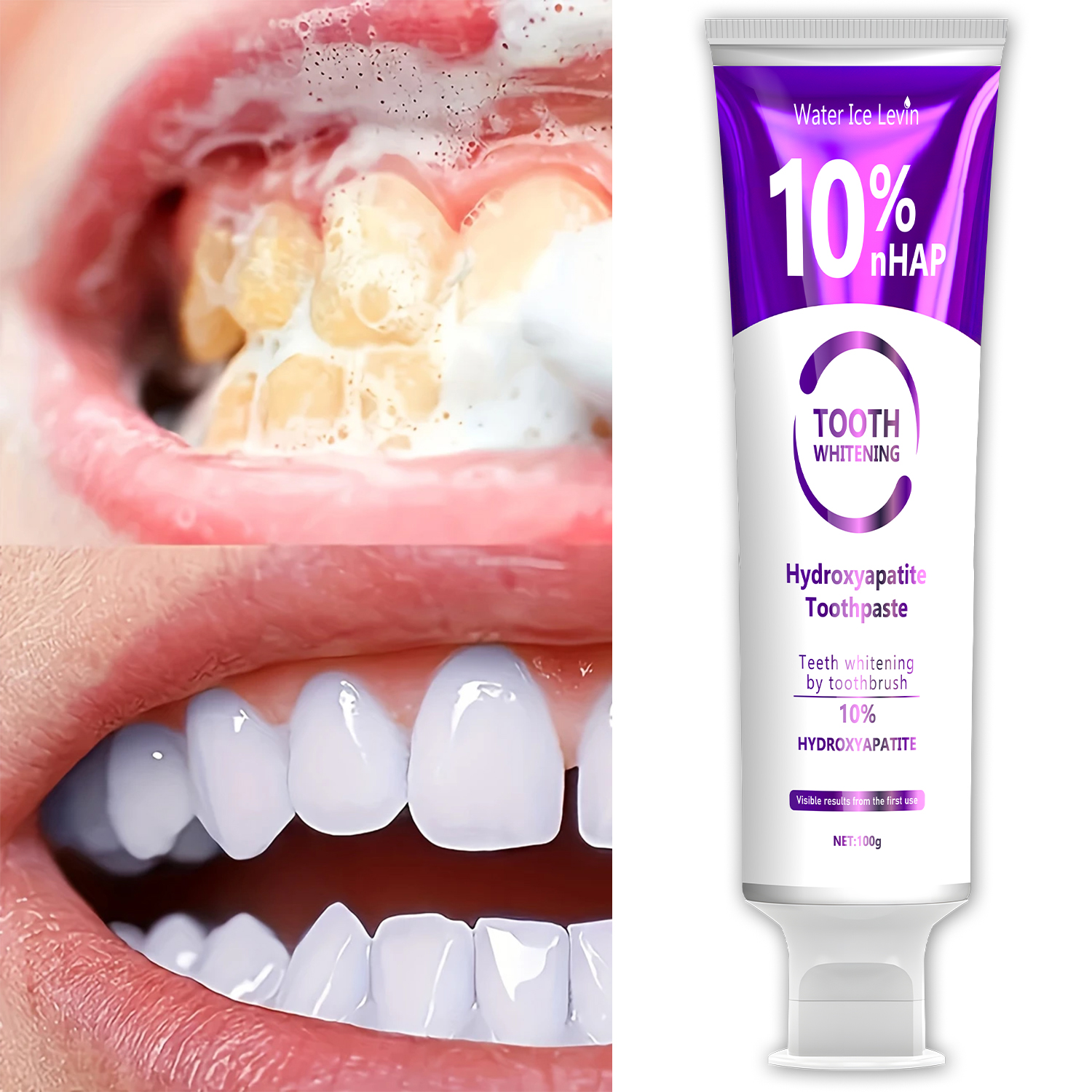 10% Nanoh Hydrogen Oxide Tooth - Teeth Whitening With Hydrogen Peroxide のレビューと価格