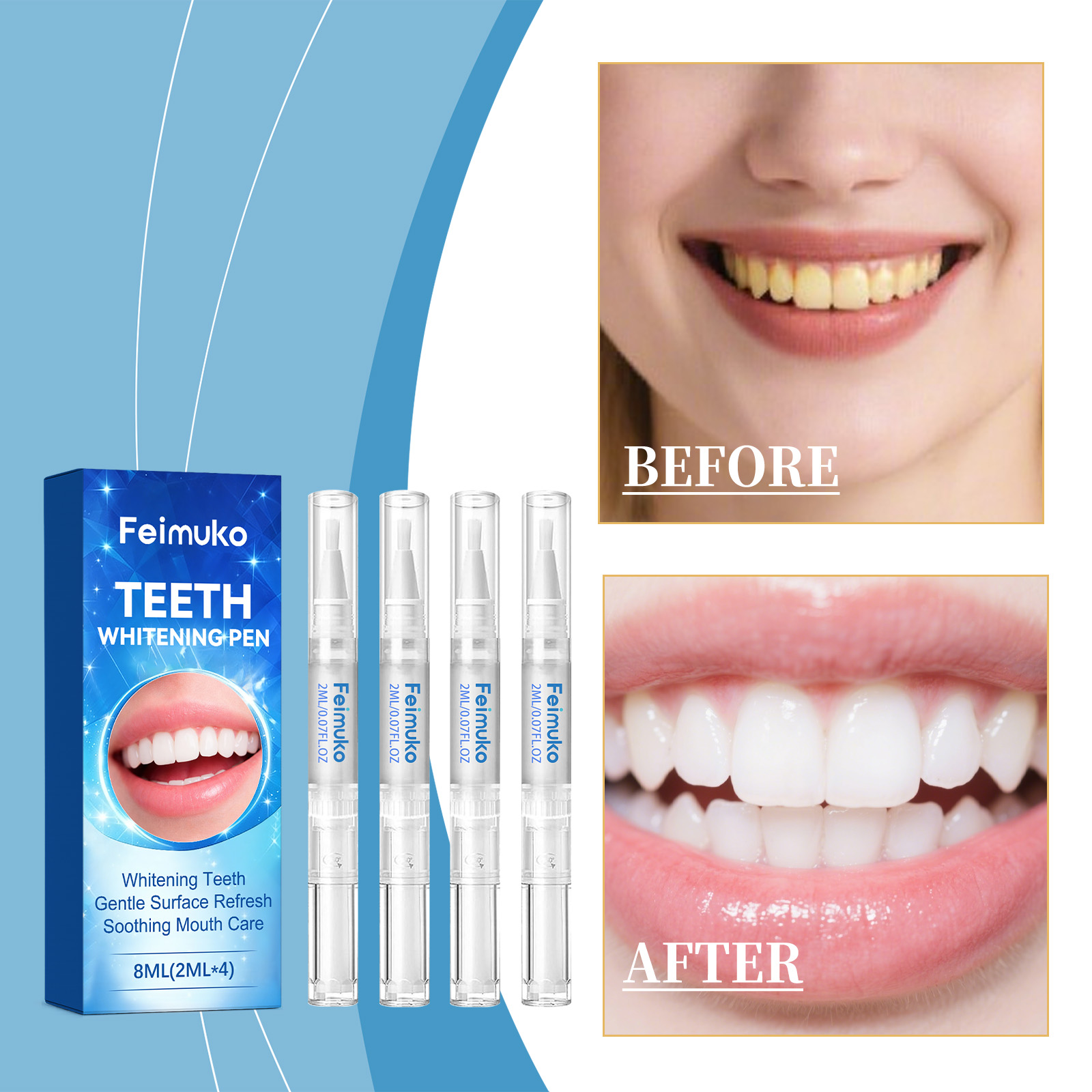 Feimuko 8ml Teeth Gel Pen Gent - Teeth Whitening With Hydrogen Peroxide のレビューと価格