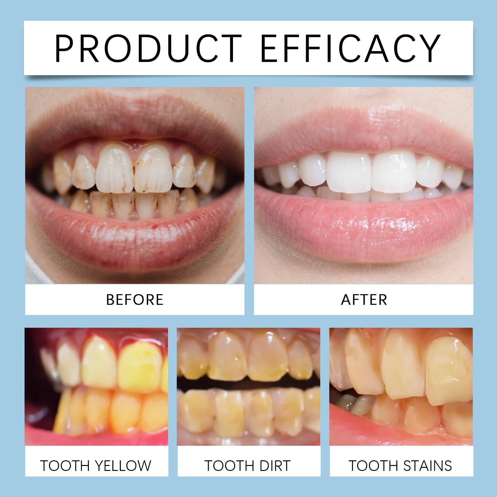 Feimuko 8ml Teeth Gel Pen Gent - Teeth Whitening With Hydrogen Peroxide のレビューと価格
