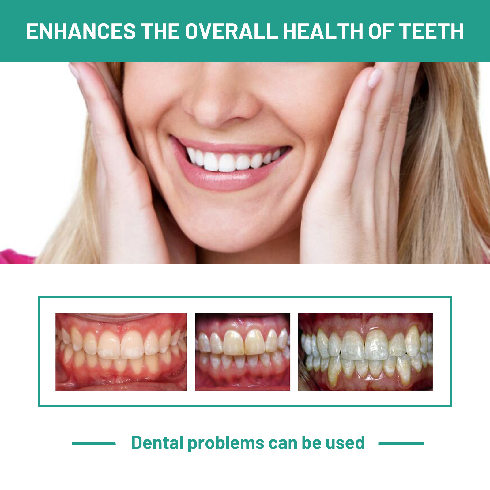 Probiotic Toothpaste Whiten To - Teeth Whitening Xylitol のレビューと価格