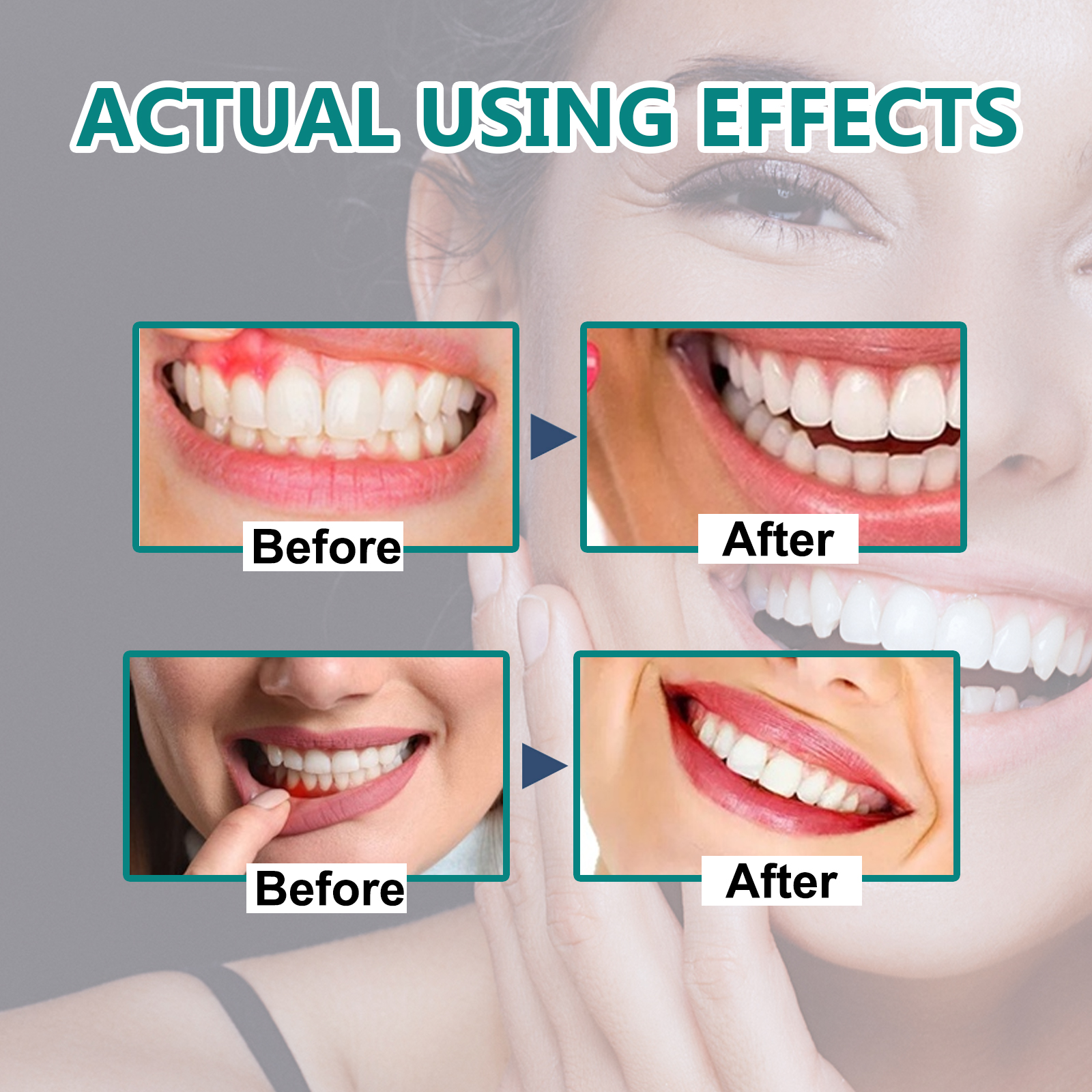5pcs Gingival Repair Drop Quic - Teeth Whitening Quick のレビューと価格