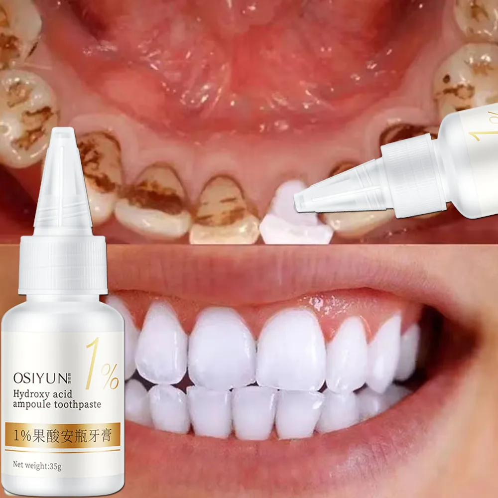 Teeth Whitening Toothpaste Fru - Teeth Whitening Xylitol のレビューと価格