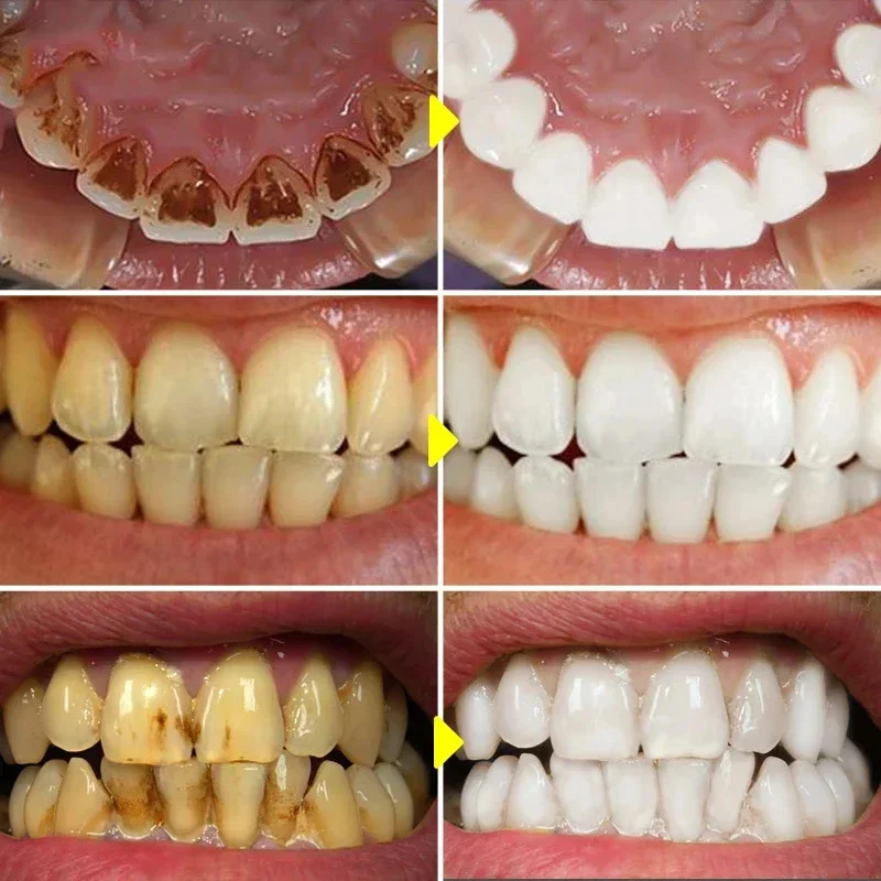 Teeth Whitening Toothpaste Fru - Teeth Whitening Xylitol のレビューと価格