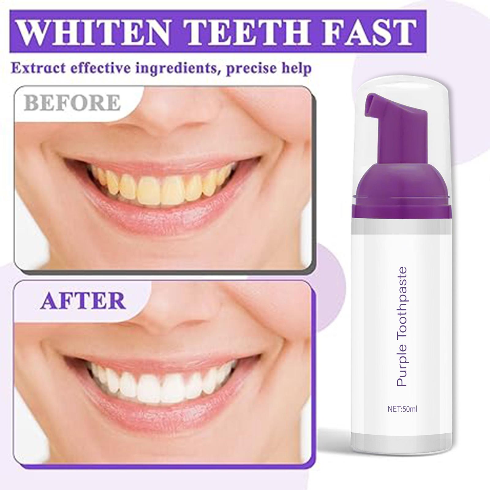 Mousse Toothpaste 50ml Brighte - Teeth Whitening Before And After のレビューと価格