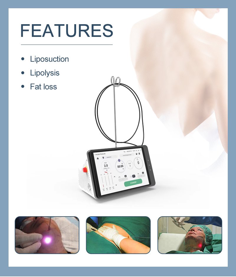 Dental Laser Teeth Whitening D - Teeth Whitening Device のレビューと価格