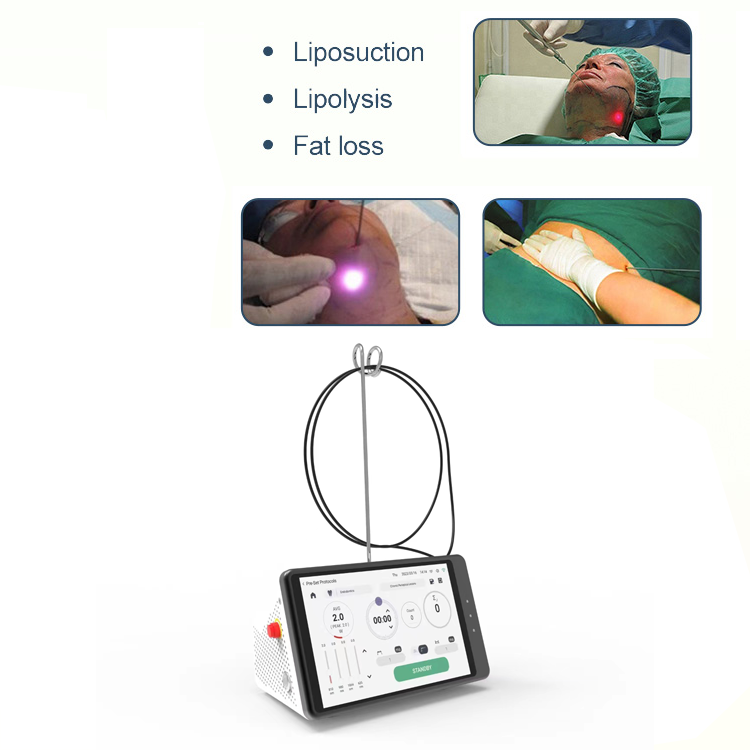 Dental Laser Teeth Whitening D - Teeth Whitening Device のレビューと価格