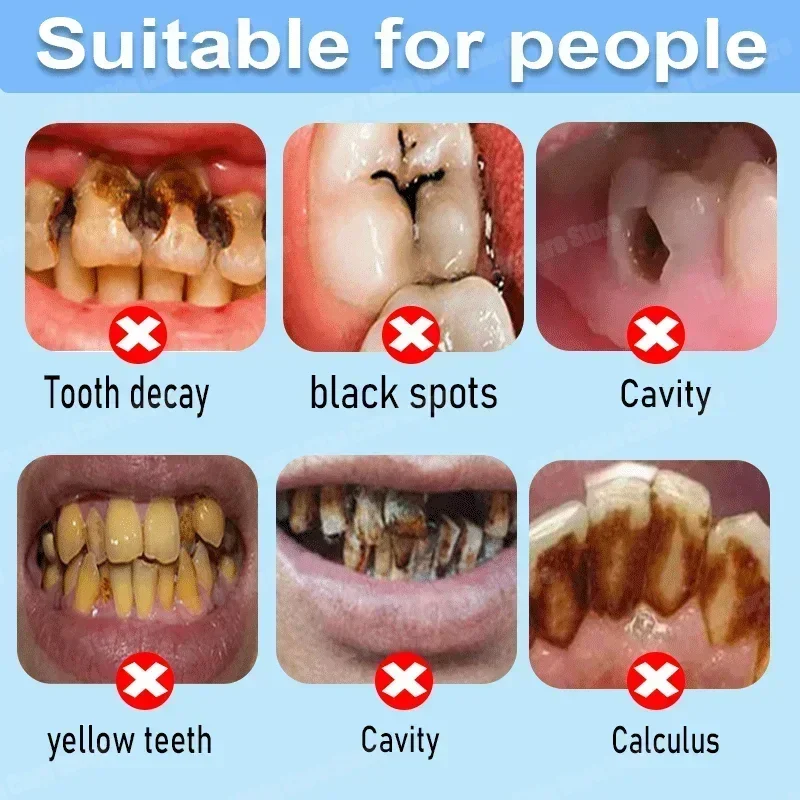 Anti Decay Toothpaste repairs  - Teeth Whitening Cream のレビューと価格