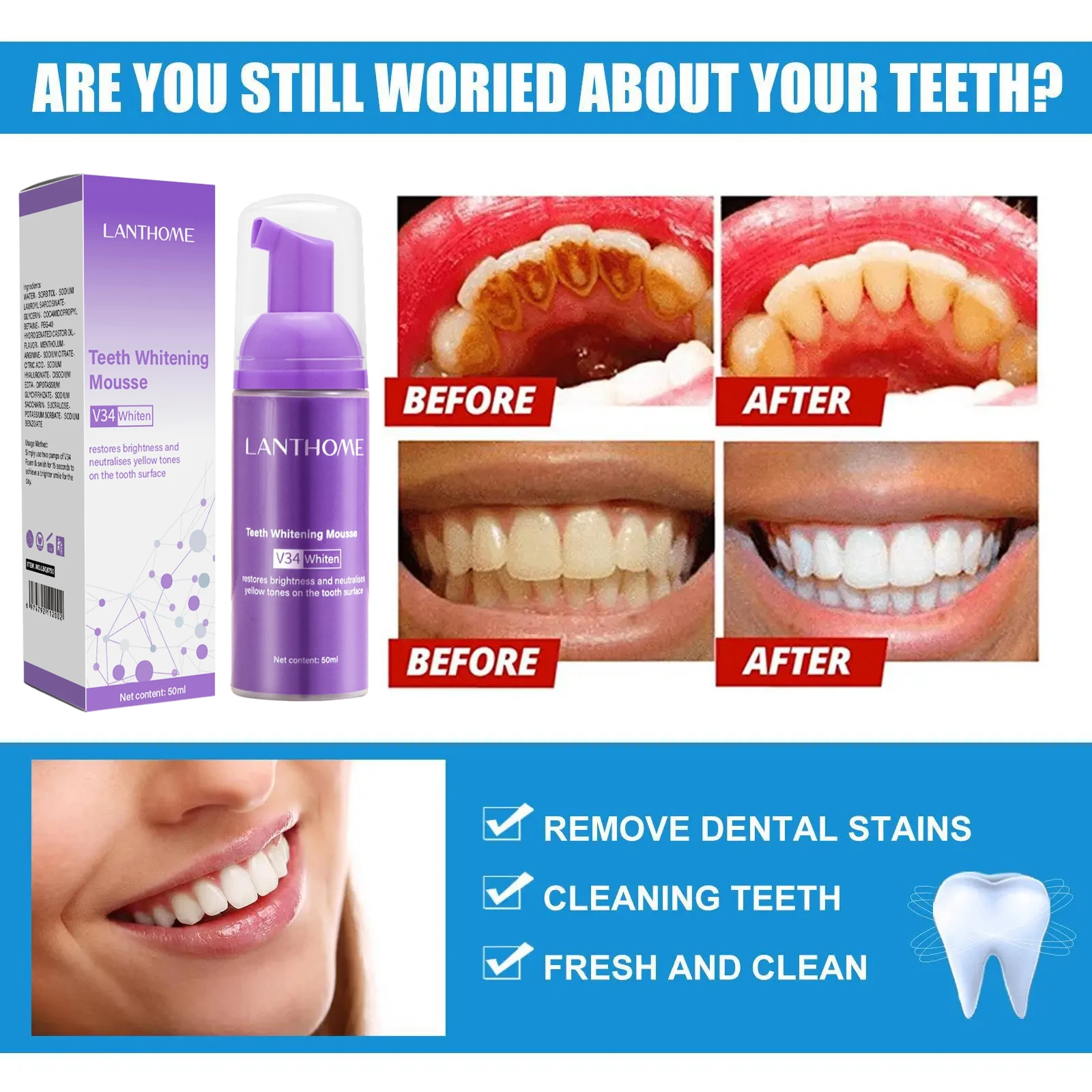 V34 Teeth Whitening Mousse Too - Teeth Whitening Xylitol のレビューと価格
