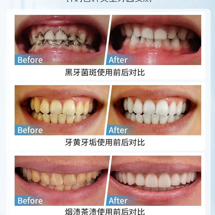 Japan Manual Tooth Stain Remov - Teeth Whitening Japan のレビューと価格