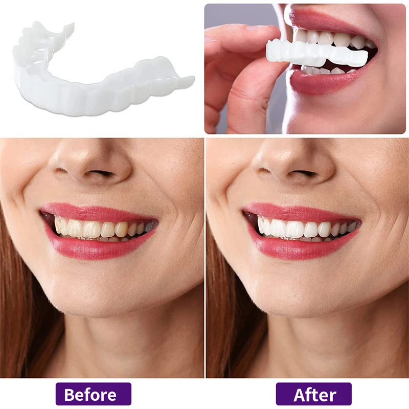 Color Matching Natural Teeth V - Teeth Whitening Options のレビューと価格