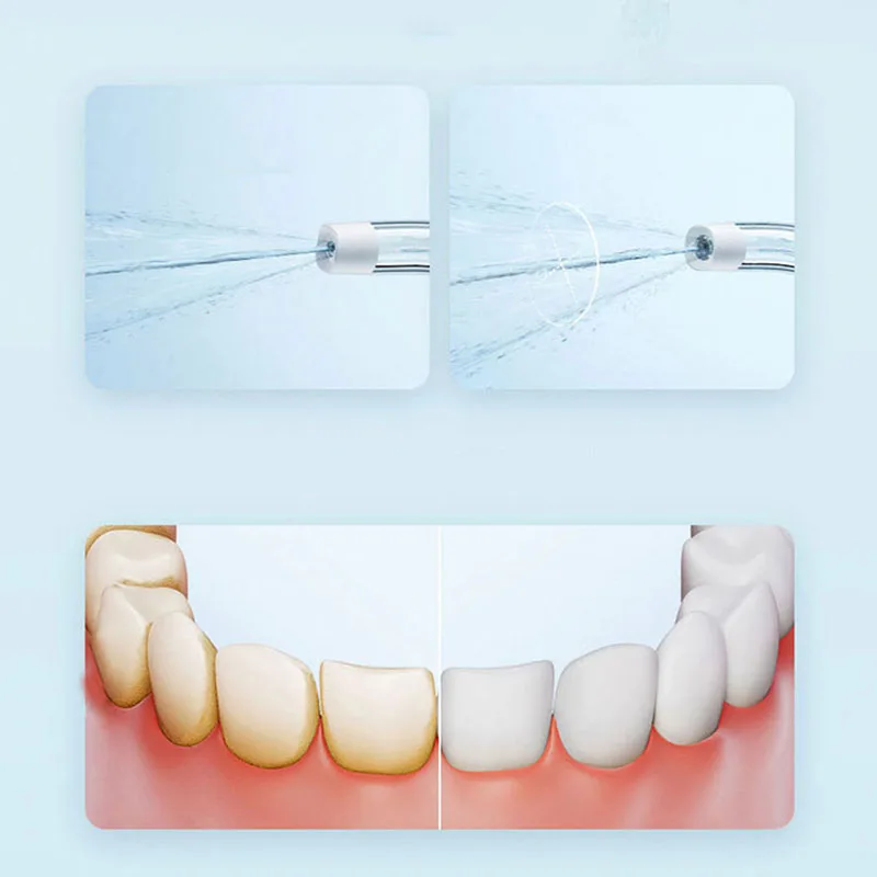 Xiaomi Portable Oral Irrigator - Teeth Whitening Quick のレビューと価格