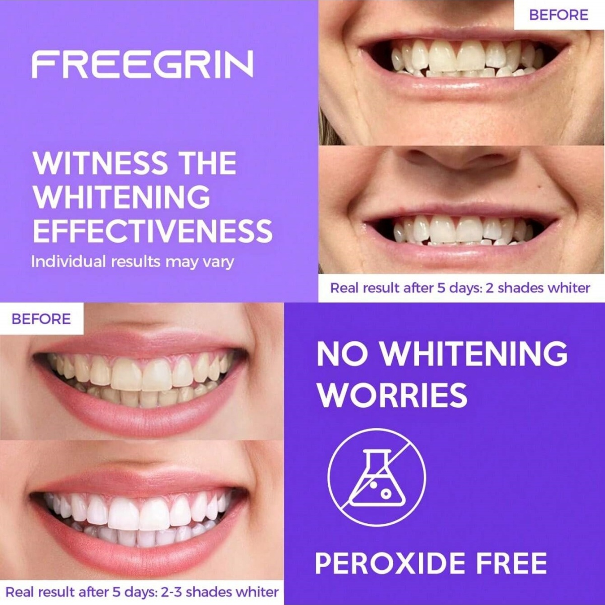 Deluxe Whitening Teeth Sticker - Teeth Whitening With Hydrogen Peroxide のレビューと価格