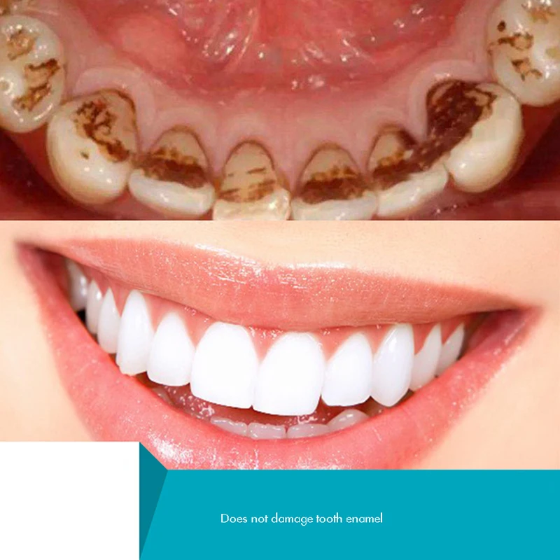 Herbal Tooth Powder, Natural T - Teeth Whitening Xylitol のレビューと価格