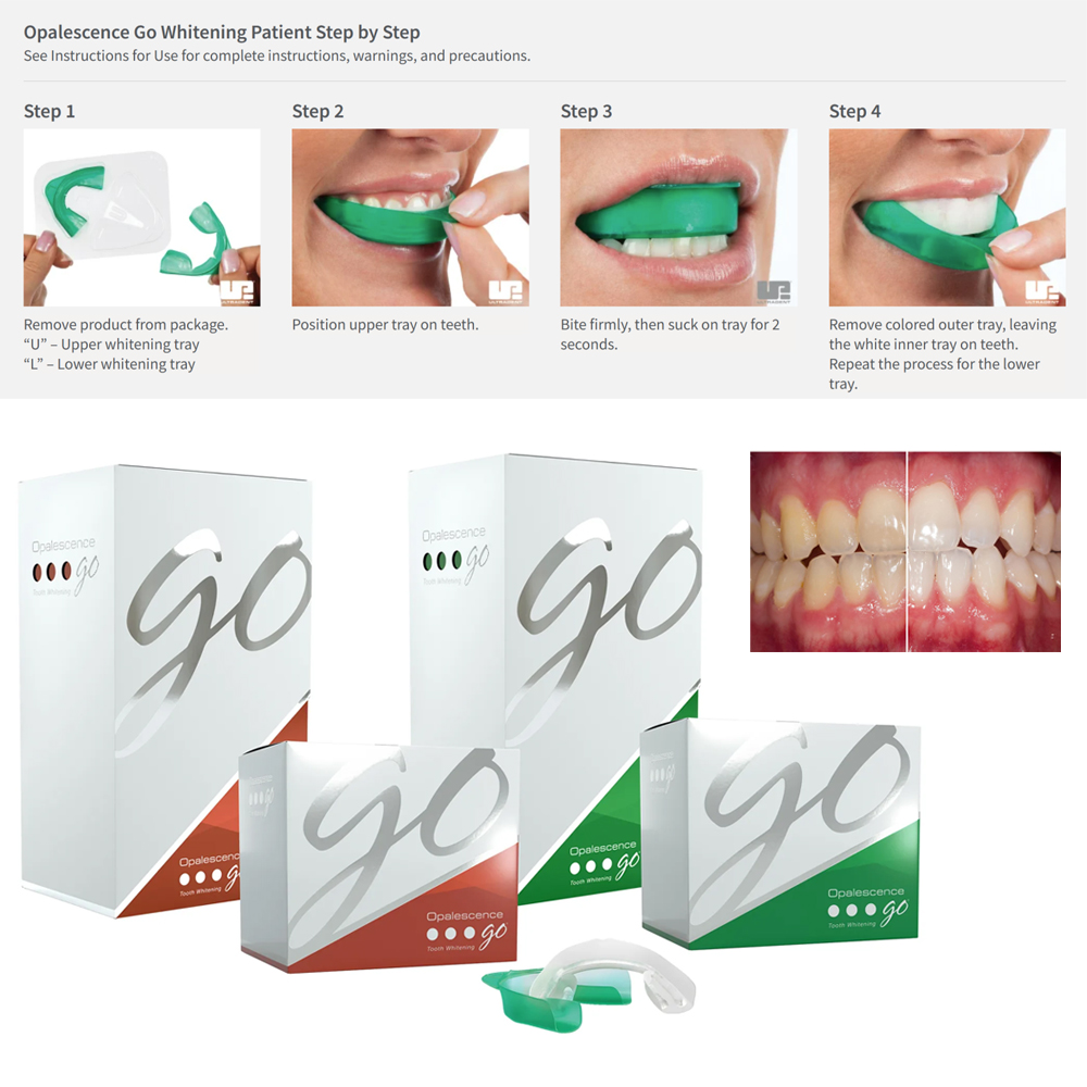 Opalescence Go Teeth Whitening - Teeth Whitening Kit At Home のレビューと価格