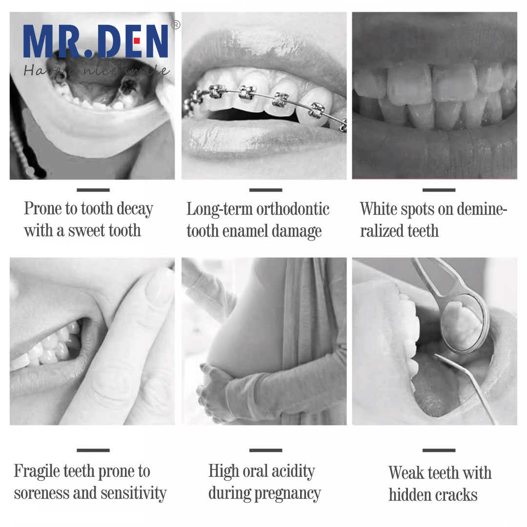Japan GC Fluoride Enhanced Den - Teeth Whitening Japan のレビューと価格