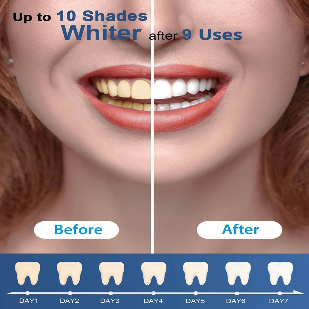 Teeth Whitening Kit - 5X LED L - Teeth Whitening Kit At Home のレビューと価格