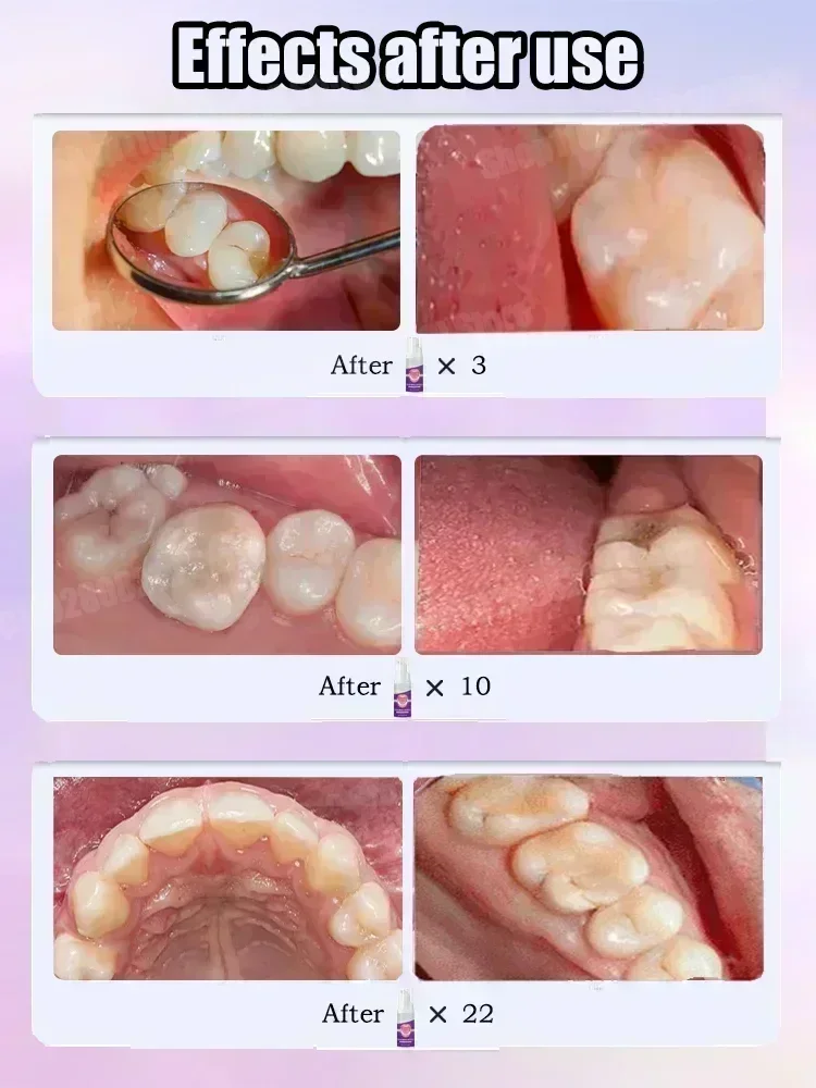 Teeth Cleaning Toothpaste Remo - Teeth Whitening Cream のレビューと価格