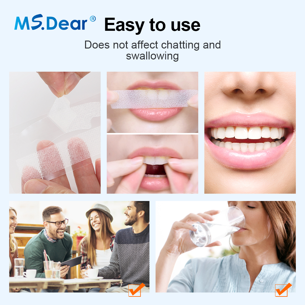 Teeth Whitening Strips Cleansi - Teeth Whitening With Hydrogen Peroxide のレビューと価格